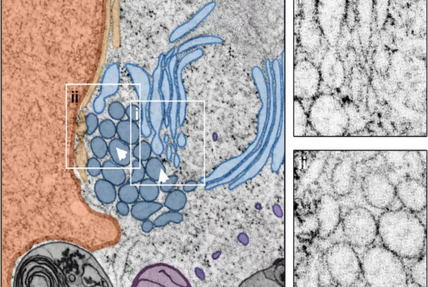 Image: Mixed crystalloid-ER and whorl morphology. Central slice through a STEM tomogram showing a patch of crystalloid-ER (dark blue) located in close proximity to a putative ER whorl (light blue) in its intracellular environment. Closer inspection of the reconstructed tomogram reveals a direct connection between the two ER morphotypes (I), as well as the presence of multiple vesicles (not present in the central tomogram section), located near the nucleus (orange) and contacting the crystalloid ER (II). Arrowheads indicate the viewing direction in Figure 6. Scale bar = 500 nm. Credit: Journal of Microscopy