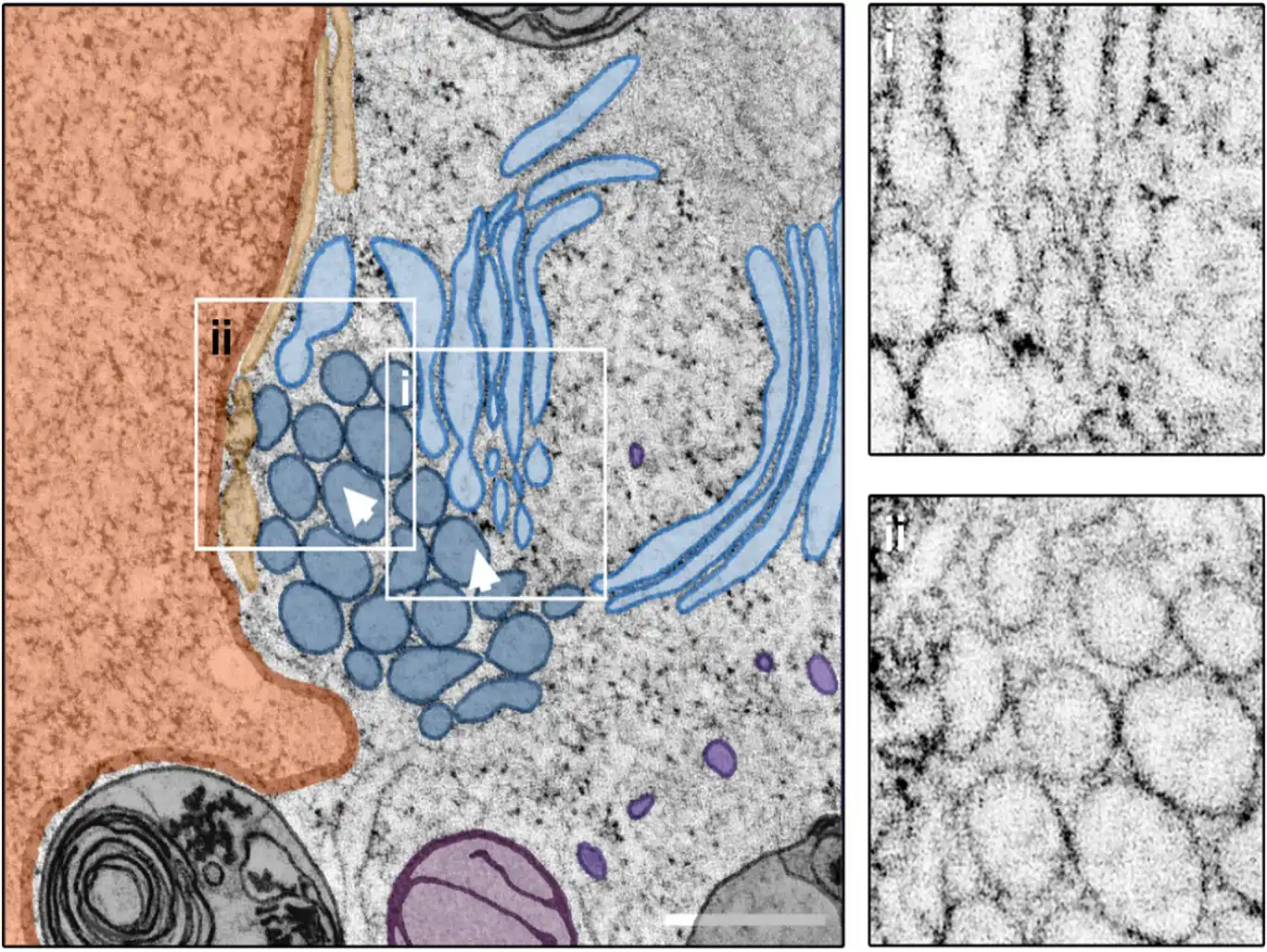 Application of STEM tomography to investigate smooth ER morphology under stress conditions